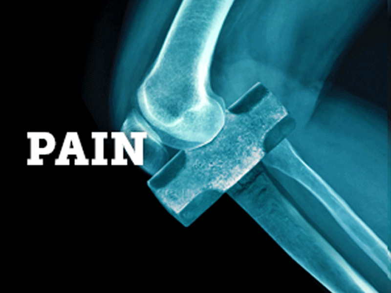 Digital campaign for University hospitals advertising bones digital banner digital marketing hospital ortho orthopedic pain web banner xray
