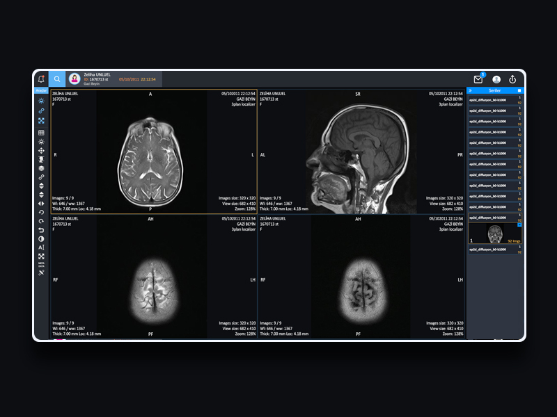 k pacs dicom viewer