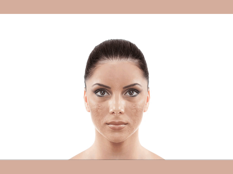 Melblok Animation animation beauty gif skin skin care transformation