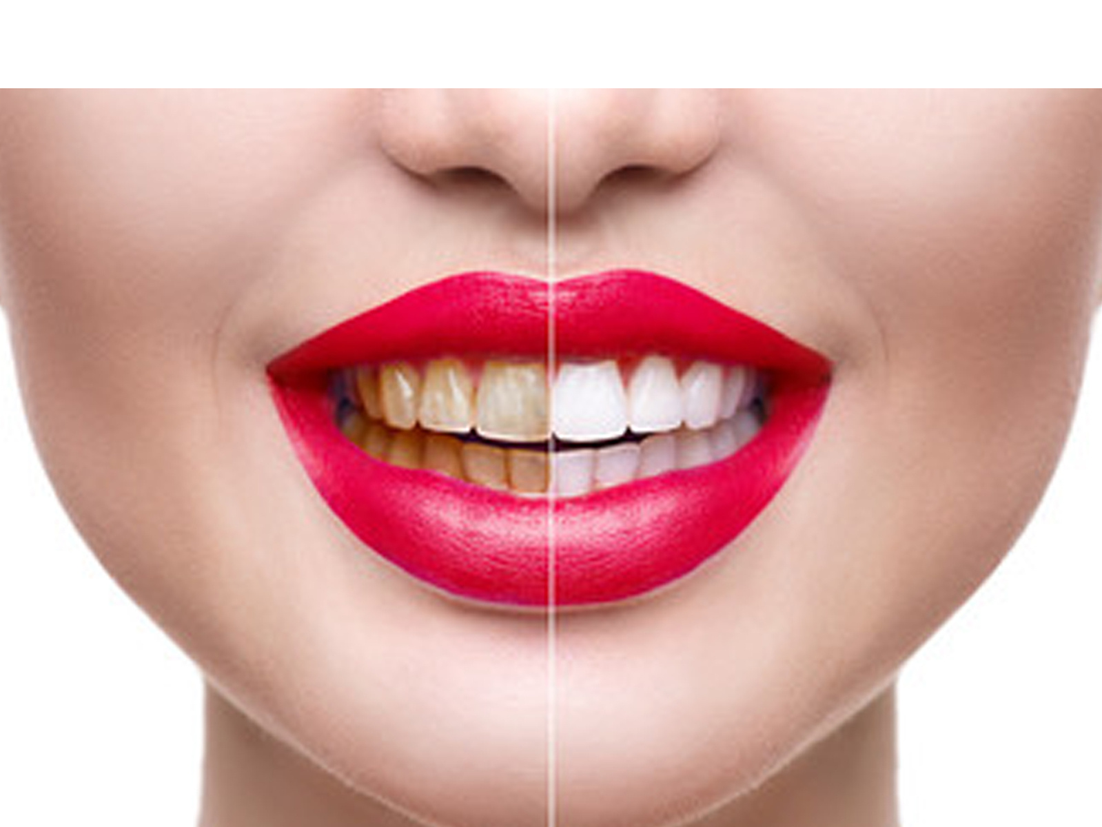 photo-editing-remove-dirty-teeth-by-karim-mostafa-on-dribbble