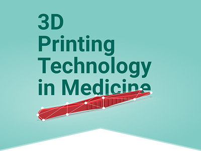 3D Printing Technology in Medicine