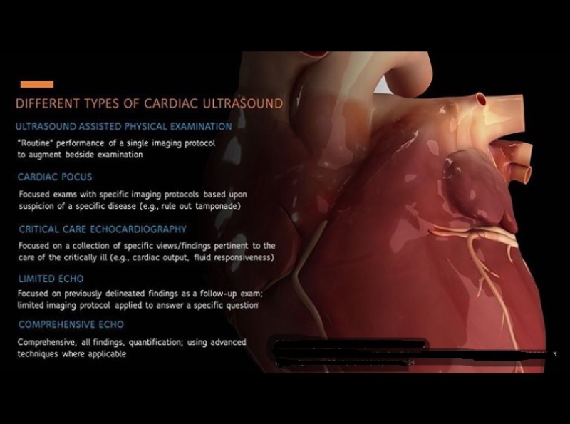 Types Of Cardiac Ultrasounds By Private Cardiologist London On Dribbble