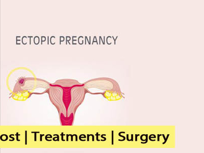 Dribbble - ectopic_pregnancy_cost_and_treatment.jpg by Niharika Jain