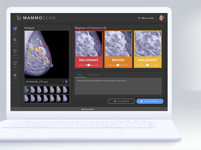 MammoScan: AI enabled mammogram toolkit ai app apple dark mode design flat healthcare healthcare app innovation interaction invision minimal ui ux web app