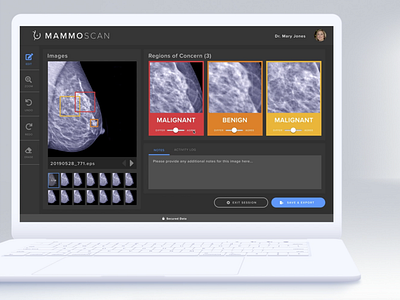 MammoScan: AI enabled mammogram toolkit