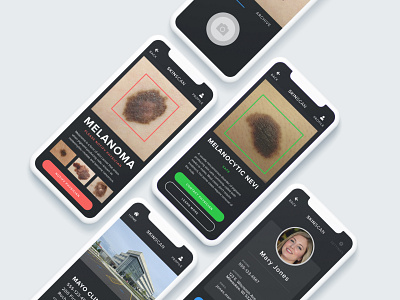 Skin Lesion Detection App app apple dark mode design flat healthcare interaction ios modern product ui ux