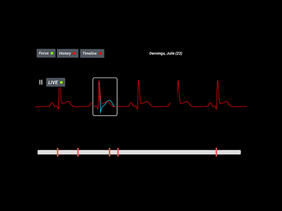 User Interface Animation in Patient Monitoring Systems adobe illustrator atom editor css html jquery sketch for mac unity3d velocityjs visual studio