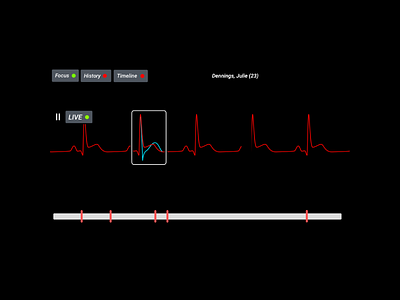 User Interface Animation in Patient Monitoring Systems