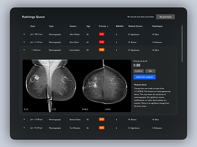 Radiology AI artificial intelligence computer vision dashboard health care table tooploox