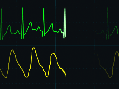 The Heartbeat Dance animation gif heart heartbeat hospital keg loop mograph monitor motion graphics pulse vitals