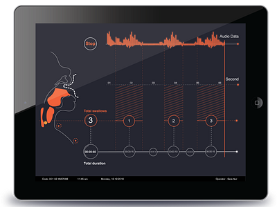 User interface design for medical products