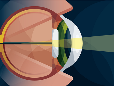 How do glasses work? eye illustration vision