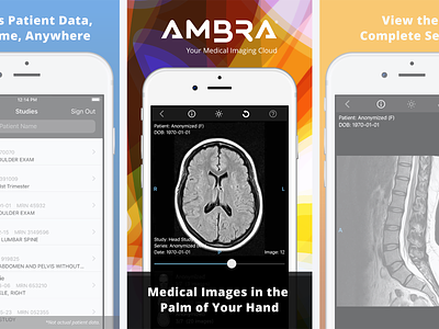 Ambra iOS App Store Screenshots
