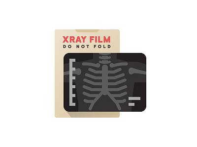 Chest Xray