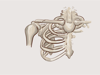 clavicle (fracture)