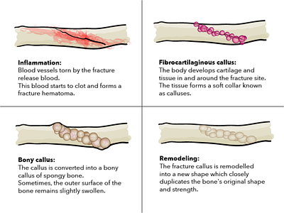 bones adobe illustrator anatomy bones drawing healing illustration vector