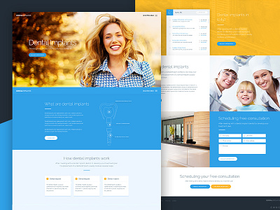 Dentalimplant: Homepage design concept