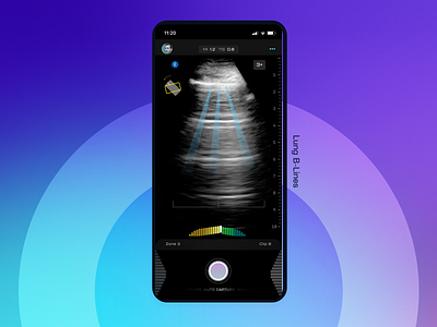 Ultrasound Prescriptive Guidance