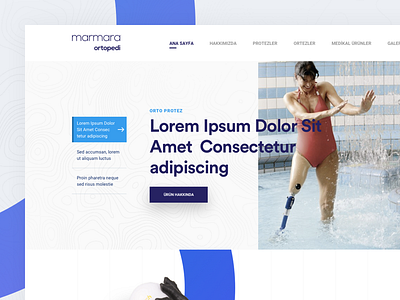 Prosthesis Landing Page