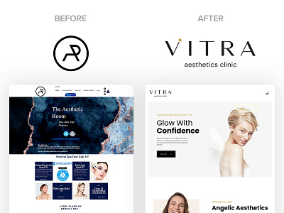 Vitra Aesthetics Clinic Brand Before & After