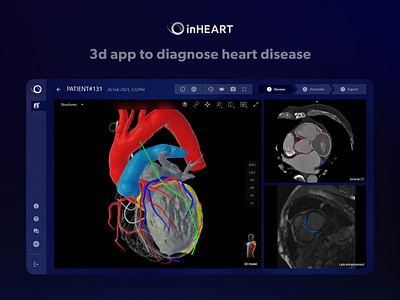 3D Visualization Medical App 3d dark theme health interaction medical ui ux