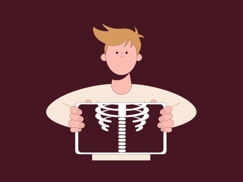 XRays by Gian Luca Scotece on Dribbble