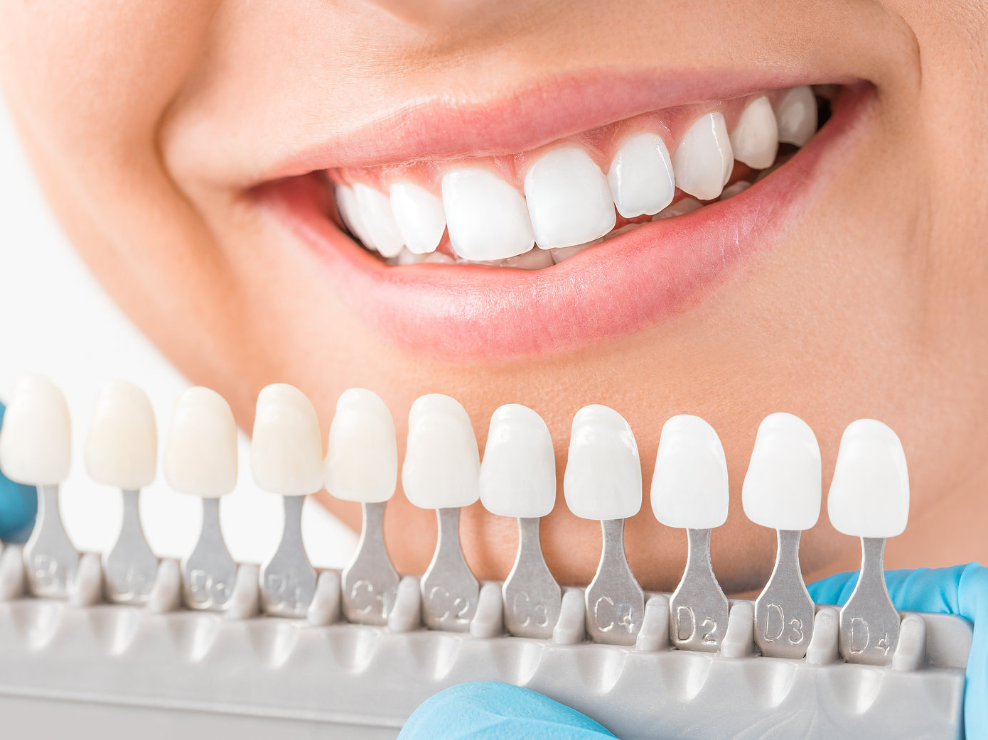 Types of Cosmetic Dental Procedures.