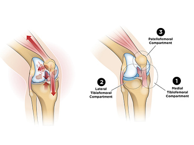 Medical Illustration