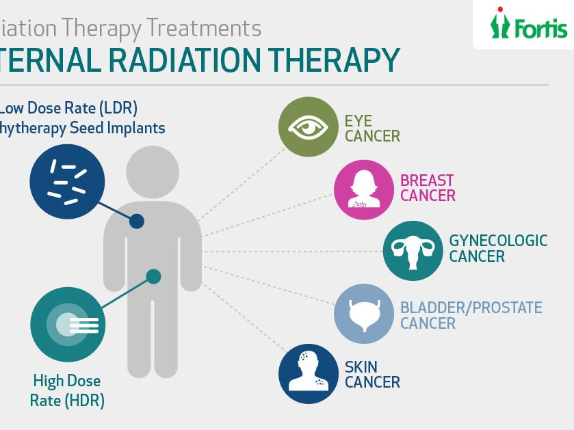 Rortis Radiation Therapy In Bangalore.