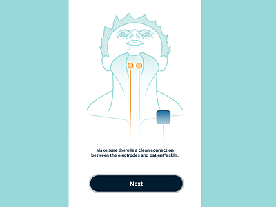 Medical Diagram diagram dysphasia electricity electrode error message estem medical throat troubleshooting