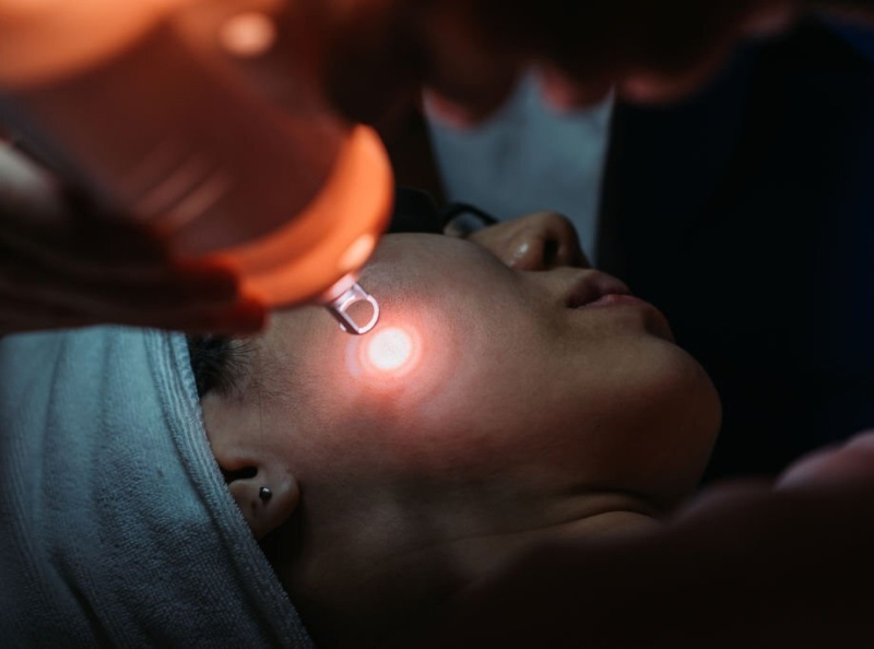 Laser Treatment for the Face Singapore is Available by Certified