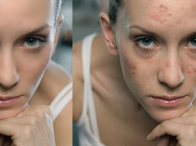 Image retouching