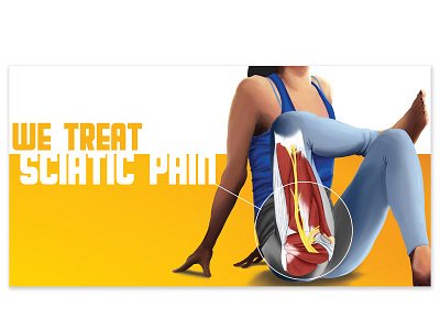 Sciatica Digital Ad advertising anatomy design digital art digital illustration drawing illustraion illustration marketing typography