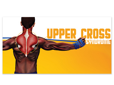 Upper Cross Syndrome Digital Ad advertising anatomy design digital art digital illustration drawing illustration marketing typography