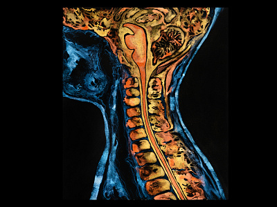 EVERYTHING'S CONNECTED — Spinal cord abstract acrylic paint brain concept art human body illustration illustration art macrocosm medical microcosm painting spinal spinal cord