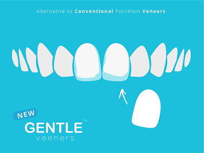 Gentle Veneers Brand Visual dental care dental illustration dental logo teeth veneers
