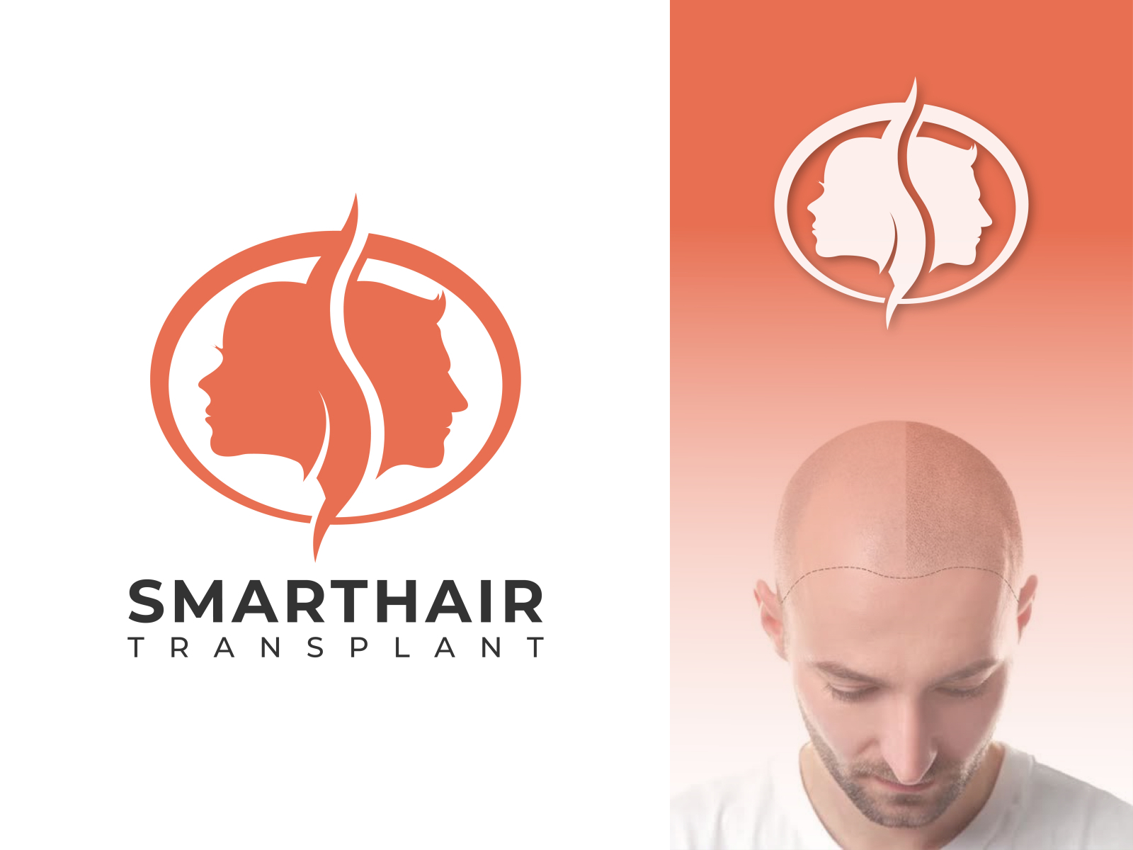 Hair Transplant Logo Design by MM Hasan on Dribbble