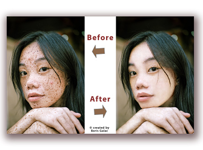 Retouching a freckled face photo photoshop retouch