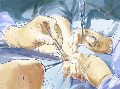 Surgery illustration medical procreate science