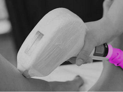 Laser Hair Removal-Revive Beauty Solutions | Spa London ON
