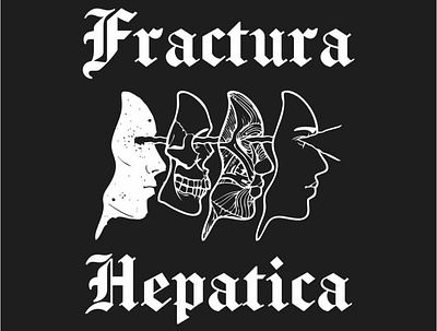 Fractura Hepatica design illustration vector