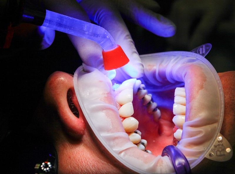 Dental Implants Bakersfield CA by Bakersfield Smile Design on Dribbble