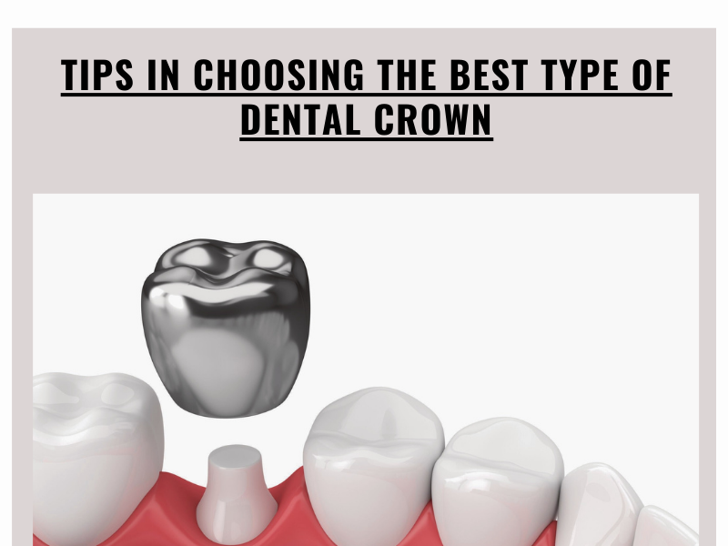 Dribbble Tips In Choosing The Best Type of Dental Crown.png by
