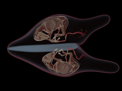 equine twin pregnancy