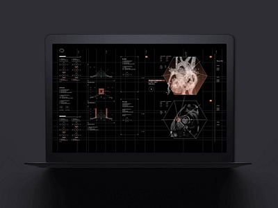 Cardiac CT Scan Interface