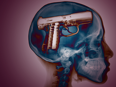 Your Mind is a Weapon gun head skull x ray