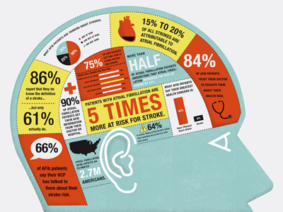 Atrial Fibrillation Poster atrial fibrillation doctor graphic illustration infographic medical poster