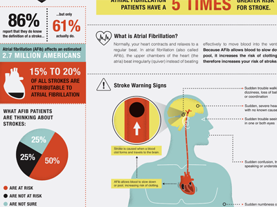 Atrial Fibrillation Poster - side 2 doctor illustration medical illustration poster