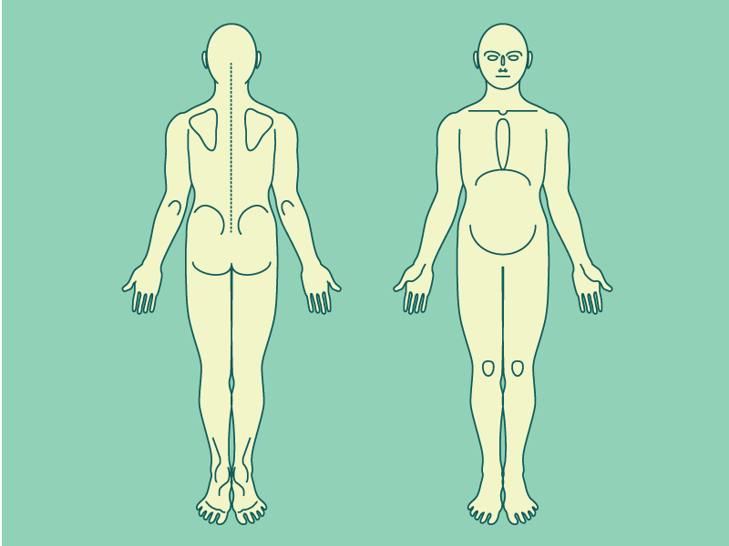 body-pain-chart-illustration-by-naomi-mar-a-szczesiul-on-dribbble