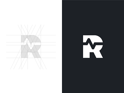 R + EKG (squiggly line)